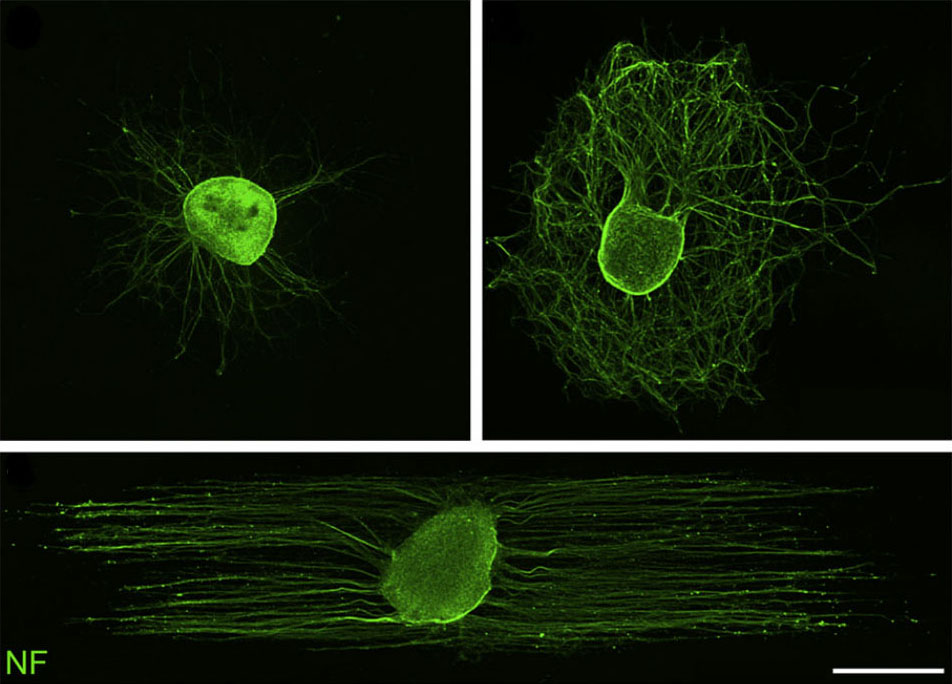 Robust CNS Regeneration After Complete Spinal Cord Transection using Aligned Poly-L-Lactic Acid Microfibers