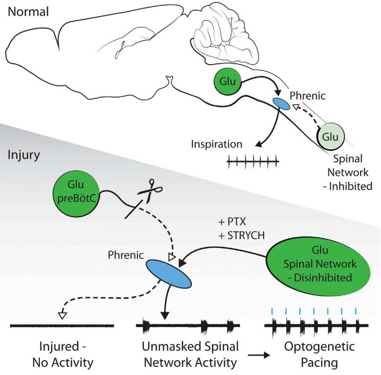 A Latent Propriospinal Network Can Restore Diaphragm Function after High Cervical Spinal Cord Injury