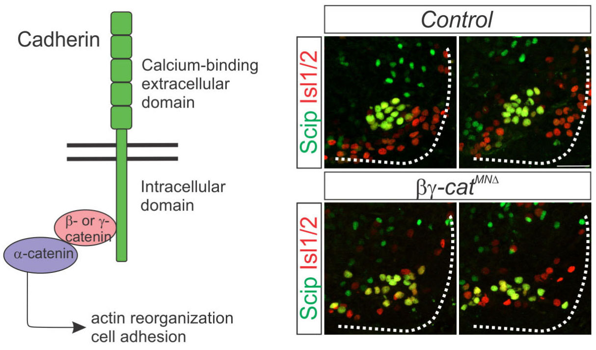 Phrenic-Specific Transcriptional Programs Shape Respiratory Motor Output