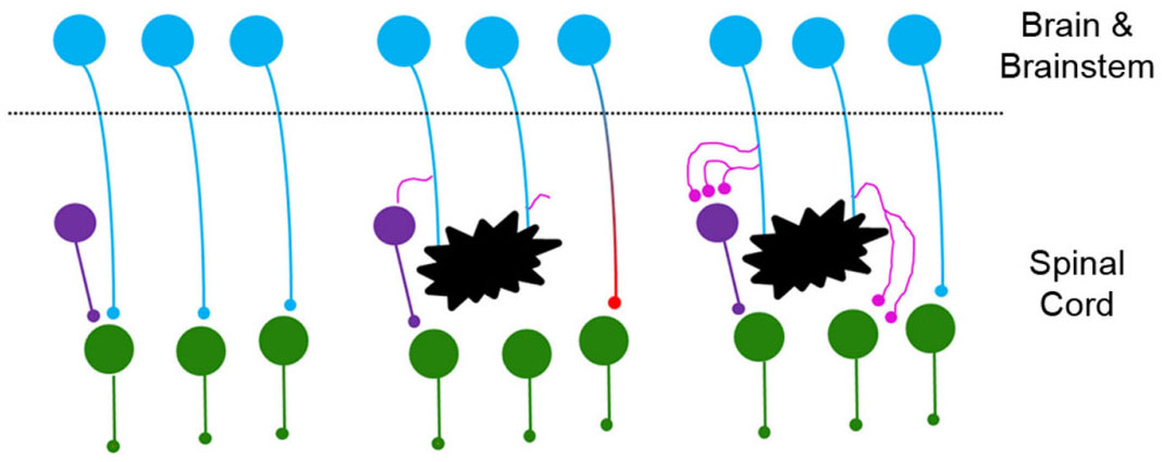 Keratan Sulfate Proteoglycans in Plasticity and Recovery after Spinal Cord Injury