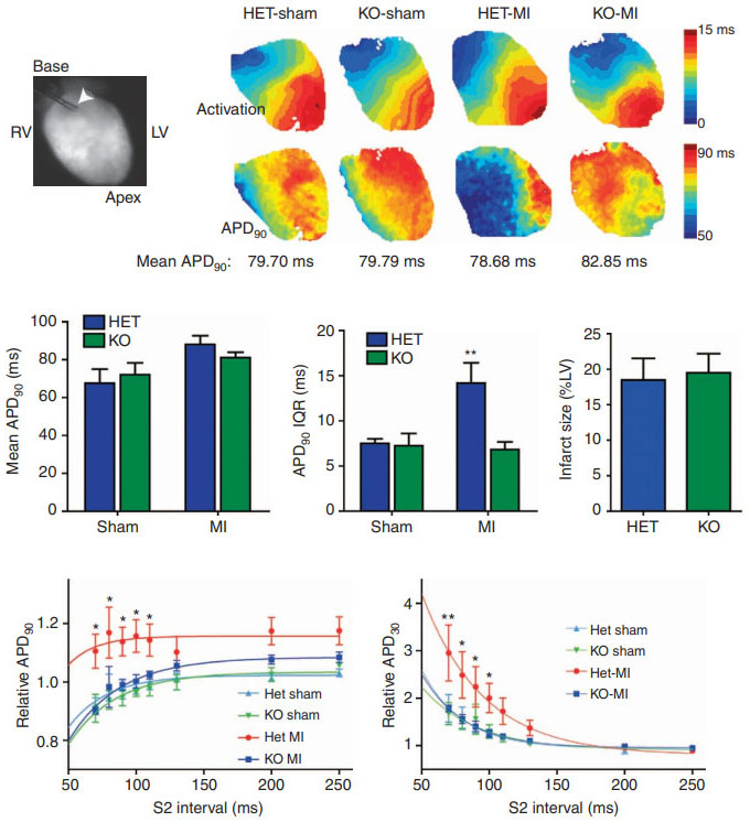 Targeting Protein Tyrosine Phosphatase σ after Myocardial Infarction Restores Cardiac Sympathetic Innervation and Prevents Arrhythmias