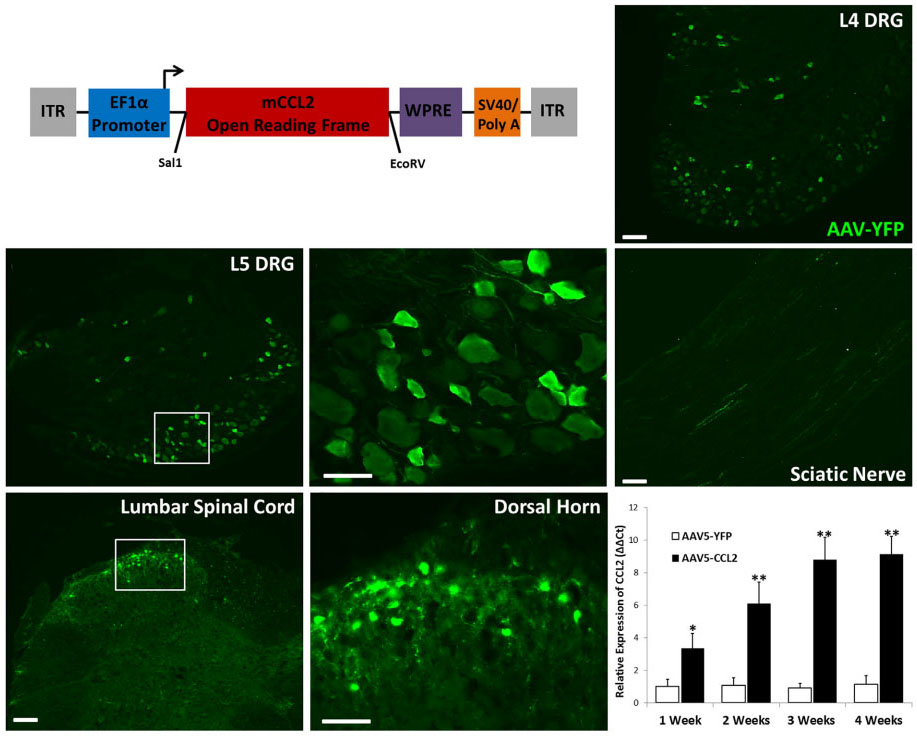 Overexpression of the Monocyte Chemokine CCL2 in Dorsal Root Ganglion Neurons Causes a Conditioning-Like Increase in Neurite Outgrowth and does so via a STAT3 Dependent Mechanism