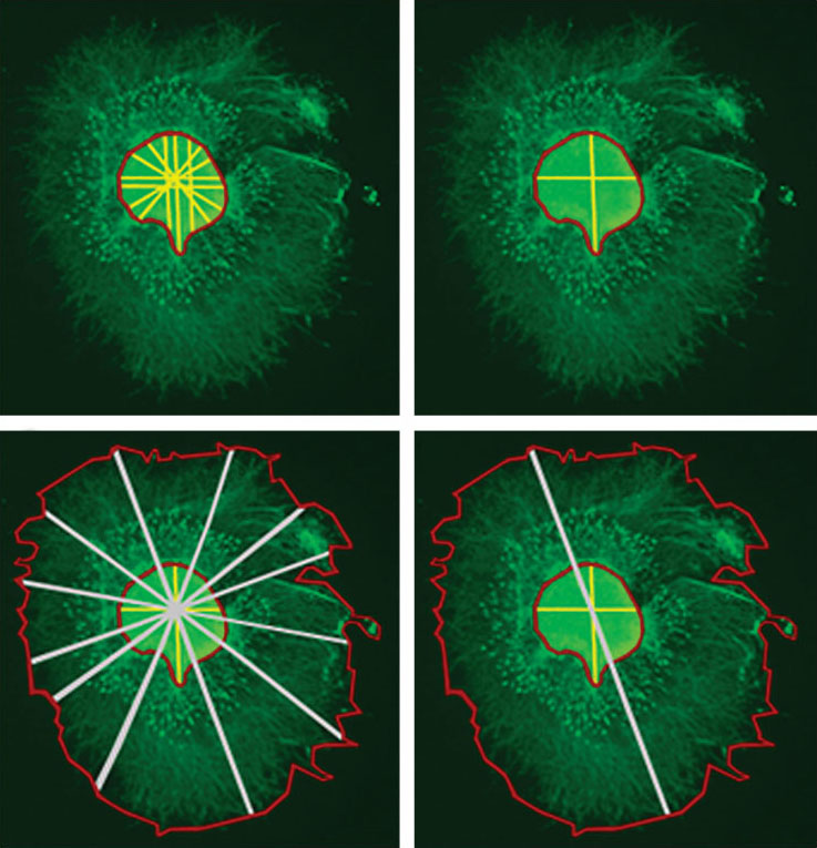 A Rapid, Quantitative Method for Assessing Axonal Extension on Biomaterial Platforms